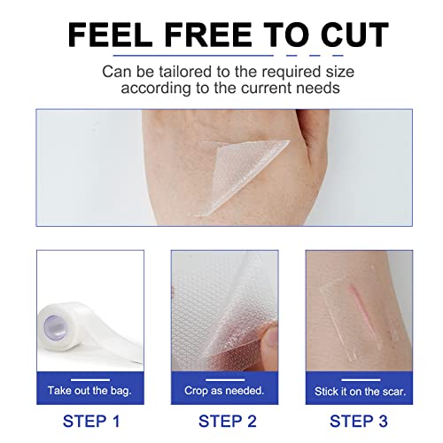 Tempaky Folhas de silicone para cicatriz 3M Fita de gel de silicone macio para cicatriz Rolo de fita