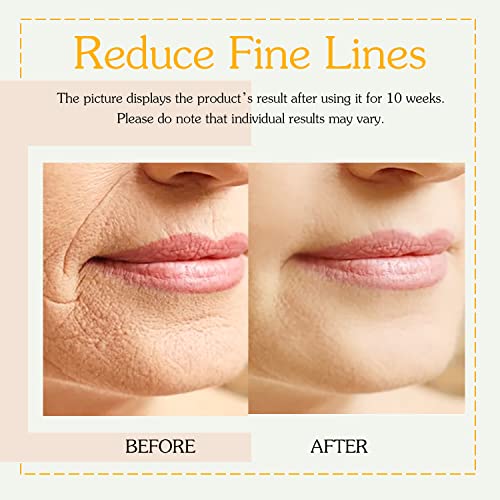 Retinol Collagen Cream With Hyaluronic Acid For Face Moisturizing And Anti Aging; Facial Moisturizer For Firming Skin Anti-Wrinkle Reduce Fine Lines With Vitamin C+E Natural-Ingredient Designed By Usa Day&Night For Men & Women #TOP1