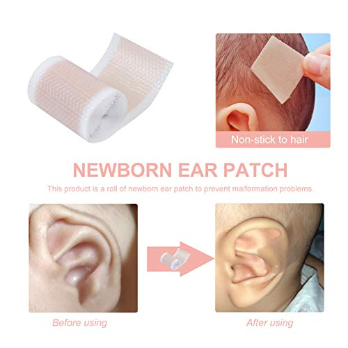 Toyvian 1 Rolo de Corretores Estéticos para Orelhas Protuberantes para Protetores de Orelha Protuber