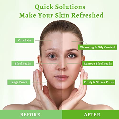 Anai Rui Green Tea Mask, Clay Mask For Poreless Deep Cleanse, Green Tea Face Mask Blackhead Remover With Kaolin, Aloe, Collagen, Pore Minimizer, Hydrating, Moisturizing 4.05Oz #TOP4