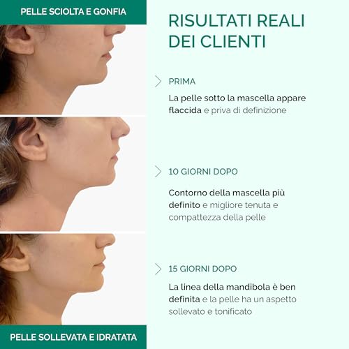 PLANTIFIQUE Doppio Mento Cintura Viso V-Line di 5