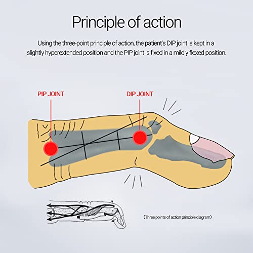6 Pieces Finger Splint Mallet Finger Support Finger Splint Brace Plastic Protector For Adjustable Finger Immobilizer For Basketball Finger Joint Protection,3 Large Sizes, Two Of Each Size #TOP5
