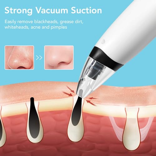 Image of SKYLIGHT Blackhead Remover Vacuum Electric Pore Cleaner for Whitehead Removal Tool, Acne Deep Face Machine, USB Rechargeable Derma Adjustable Suction & Interchangeable Heads Facial Device Men Women
