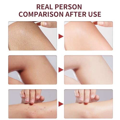 Peach Exfoliator Face Scrub,Pore Face Scrub,Nourishing Exfoliating Cream,Shrink Pores & Improve Rough Skin,Arm & Back & Leg,Anti Acne Scrub for Face,Hand Scrub Exfoliator-Dark Spot Cleanser-All Skin - Image 6