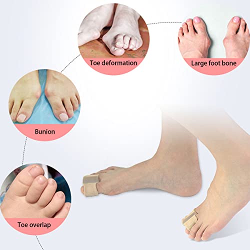 Samoka Toes Separators,2 Pcs Gel Toe Spacers Bunion Corrector, Silicone Toe Spacers With Soft Gel Lining For Women Men #TOP1
