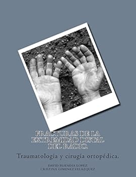 Paperback Fracturas de la extremidad distal del radio. [Spanish] Book