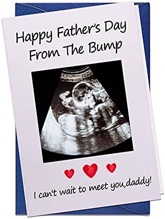 WaaHome Funny First Fathers Day Card for First Time Dad from Baby, Fathers Day Card with Photo Insert, 1st Fathers Day Gift Card for Dad, New Dad, Daddy, Father to Be
