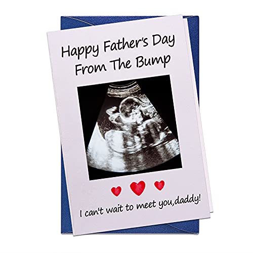 Waahome Funny First Fathers Day Card For First Time Dad From Baby, Fathers Day Card With Photo Insert, 1St Fathers Day Gift Card For Dad, New Dad, Daddy, Father To Be #TOP12