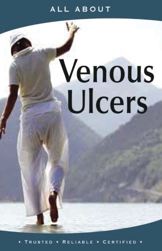 All About Managing Venous Ulcers (All About Books) #TOP1