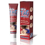 Crema para eliminar verrugas en cuerpo y manos, rápido y eficaz. Aplicable de verrugas para la mayoría de las partes del cuerpo