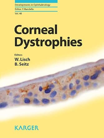 Corneal Dystrophies: 48-Wow! eBook