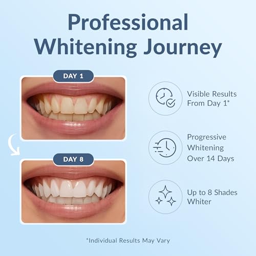 Professional Teeth Whitening Strips - Pack of 44 Strip - 22 Treatments Kit - Safe for Enamel - Non Sensitive Teeth Whitening - Whitening Without Any Harm + Mouth Opener Included - Thumbnail 3