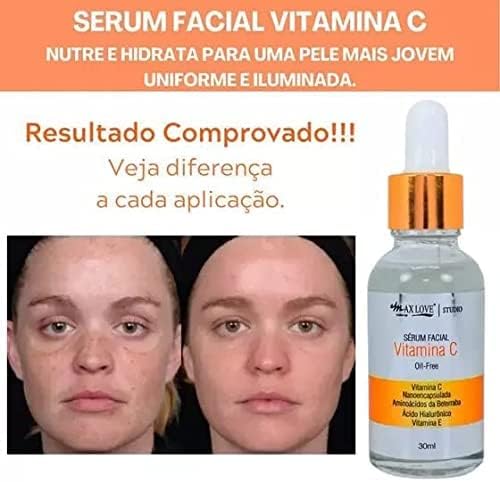 Sérum Facial Vitamina C Oil-free New Max Love 30ml