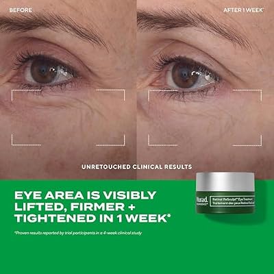 Murad Retinal Trial Kit - Lift and Resculpt with Retinal 2-Piece Trial Kit ($73 Value) - Anti-Aging Set Encapsulated Retinal - Retinal Serum 0.5Fl Oz, Retinal Eye Cream 0.11Fl Oz