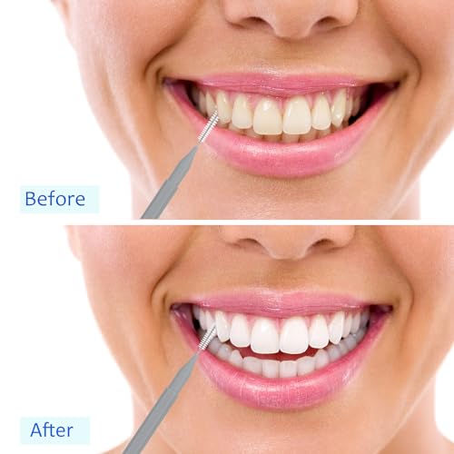 Image of Patelai 100 Pieces Braces Dental Brush for Cleaner Interdental Toothpick Dental Tooth Flossing Head Oral Hygiene Flosser Toothpick Cleaners Tooth Tool(Black, Grey,Yellow,Various Sizes)