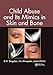 Child Abuse and its Mimics in Skin and Bone