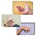 Restorative Medical BendEase Hand Splint - Wrist Pain Support for Carpal Tunnel, Arthritis and Stroke Recovery (Large - Left)