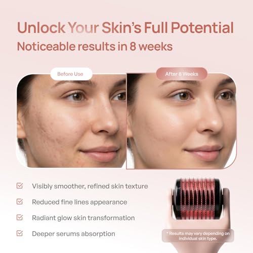 Derma Roller for Hair & Skin 0.25mm Titanium Needles Pink