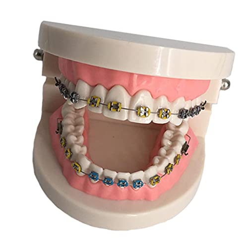 1 Peça Modelo de Ensino de Ortodôntico Educação de Ensino de Atendimento Odontológico