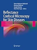 Reflectance Confocal Microscopy for Skin Diseases