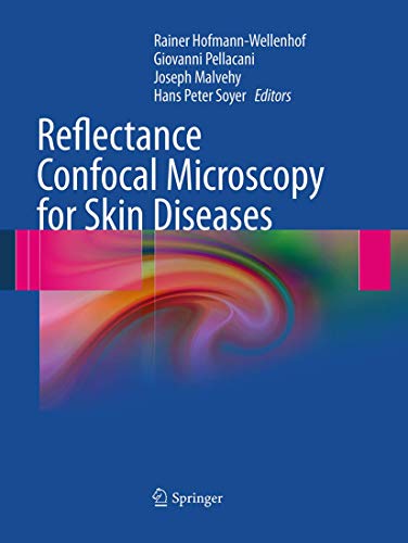 Reflectance Confocal Microscopy For Skin Diseases