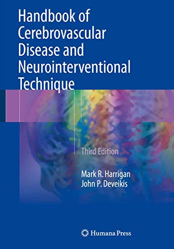 Handbook of Cerebrovascular Disease and Neurointerventional Technique (Contemporary Medical Imaging) Handbook of Cerebrovascular Disease and Neurointerventional Technique (Contemporary Medical Imaging)