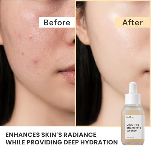 Dewy Rice Glow Serum Korean Face Serum - Image 3