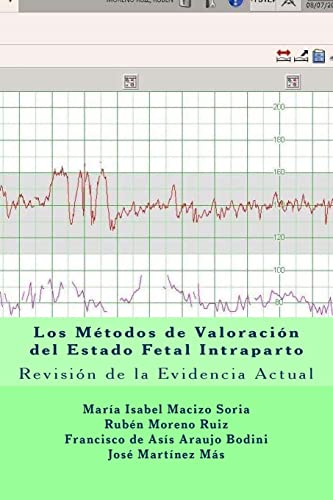 Los Métodos de Valoración del Estado Fetal Intraparto: Revisión de la Evidencia Actual (Volume 5) (Spanish Edition)