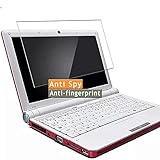 lenovo s10-2 windows 10 Bitte beachten Sie, dass diese Bildschirmschutz aus flexiblem Kunststoff besteht. Aufgrund der gekrümmten Kante des Displays wird es absichtlich kleiner als das Display hergestellt.