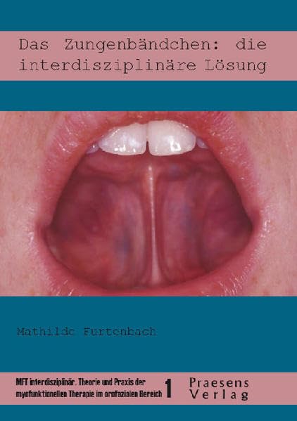 Das Zungenbändchen: die interdisziplinäre Lösung: Sprachtherapeuten in Zusammenarbeit mit Kieferorthopäden, Stillberaterinnen und chirurgisch tätigen ... Therapie im orofazialen Bereich)