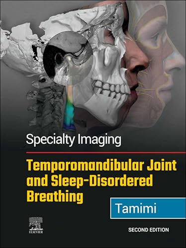Specialty Imaging: Temporomandibular Joint and Sleep-Disordered Breathing E-Book