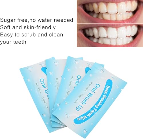 Image of 100Pcs Finger Teeth Wipes, Dental Floss Wipe Cloth Tooth Cleaning Tool for Oral Deep Cleaning Teeth Whitener Strips Dental Finger Toothbrush Oral Finger Wipes Removing Teeth Stains