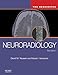 Neuroradiology: The Requisites (Requisites in Radiology)