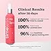 Timeless Skin Care HA Matrixyl 3000 with Rose Spray - Skin Mist with Hyaluronic Acid - Fragrance-Free Hydrating Face Spray - Soothing Matrixyl Skin Care Mist - 4 oz