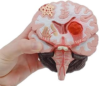 Human Brain Disease Brain Anatomical Model Model Neurosurgery Cerebral Hemorrhage Cerebral pathological Medical Teaching Model