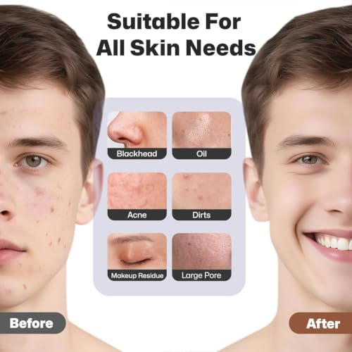PRITECH Facial Cleansing Brush, Rechargeable Silicone Face Scrubber with Heat Massage End, Vibrating Exfoliator Scrubber for Deep Cleaning, Waterproof Face Brush for Women and Men (Black) - Image 6
