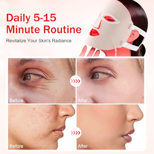 Image of Red Light Therapy Mask, Red Light Therapy for Face, 7 Colors LED Facial Mask for Wrinkle Remove & Anti Aging, Skin Care Home Travel Use,Pink (Upgraded Version)