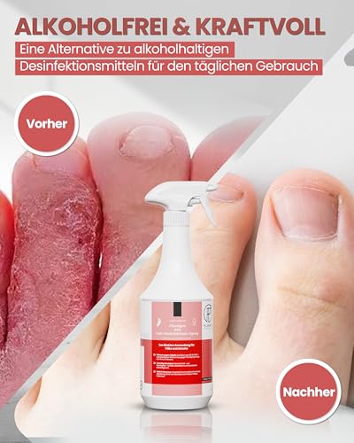 1L SOS Desinfektionsspray für Füße & Schuhe | Planet Sensitive® wirksam gegen Fußpilz, Bakterien, Viren, Hefepilze & Gerüche | Fuß-Desinfektion-Spray | Made in Germany | Sprühflasche