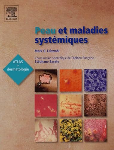 Peau et maladies systémiques