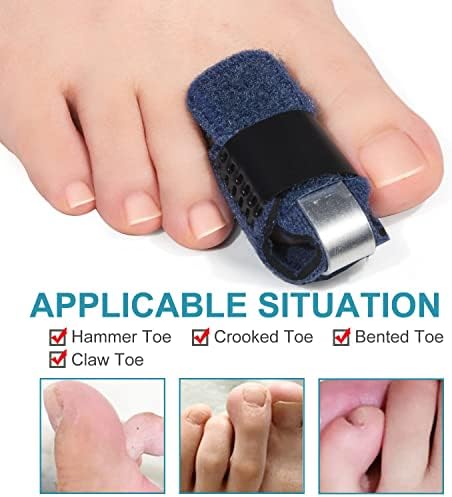 Welnove 1 Pair Toe Splint,Toe Straightener for Hammer Toe,Bent Toe,Claw Toe,Crooked Toe,Toe Wrap to Align and Support Toe -- Blue