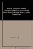 Atlas of Positron Emission Tomography of the Brain/Atlas Der Positronen-Emissions-Tomographie Des Gehirns 0387156364 Book Cover