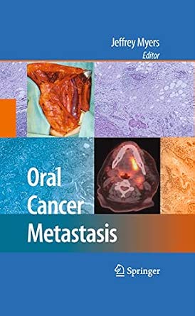 Oral Cancer Metastasis 2010th Edition-Wow! eBook