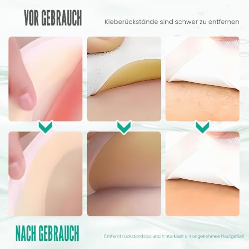 3 Flaschen Pflasterentferner Spray, Klebereste Entferner für die Haut, zum Entfernen von Klebrigen Klebstoffen Wie Pflastern,Latex, Bandagen, Mull Usw Wird mit Einem Handtuch Geliefert（15ml)