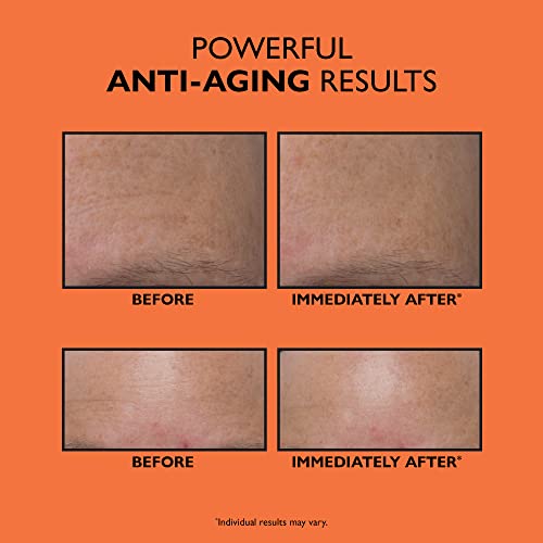 Peter Thomas Roth Anti-Aging Triple Acid Peel | Exfoliator And Aha/Bha Peel For Fine Lines, Wrinkles, Uneven Texture And Tone #TOP26