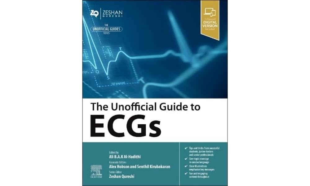 The Unofficial Guide to ECGs