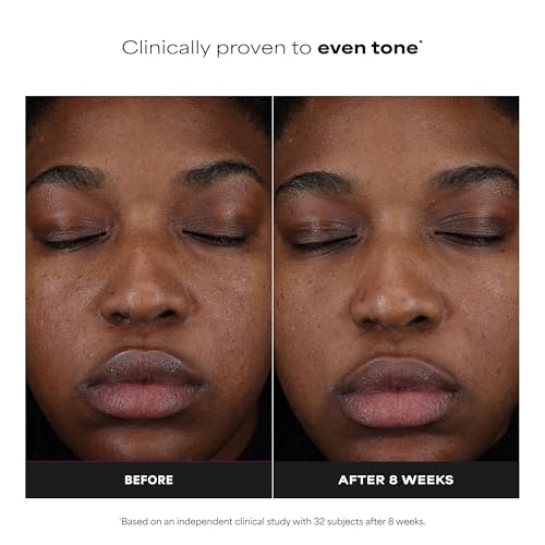 Paula's Choice 25% Vitamin C Serum, view 3