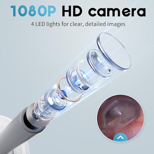 Image of Otoscope Ear Camera with 1.21 inch Screen, 1080P Ear Scope with 4 LED Lights, Otoscope Camera for Adults, Support Photo & Video, Type-C Charging with Computers, Baby Essentials, Home Medical | 1.21 inch Screen for real-time viewing. Capture photos and videos, Connect to PC, Type-C rechargeable.