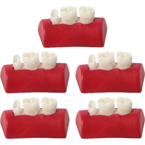 Lipfer Modelo De Ejercicio De Incrustación Dental, 5 Uds., Modelo De Ejercicio De Relleno De Resina Tipodont, Modelo De Entrenamiento De Dientes para Estudio Pedagógico De Odontología