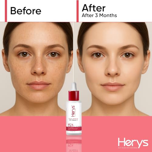 Image of Herys 15% Vitamin C Serum for Glowing Skin | for Oily, Dry & Combination Skin | Reduce Pigmentation & Dark Spot | Non-Irritating, Hydrating & Soothing | Face Serum for Men & Women | 30ml