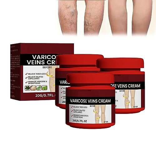 Crème varices pour soulager les jambes lourdes et réduire les varicosités